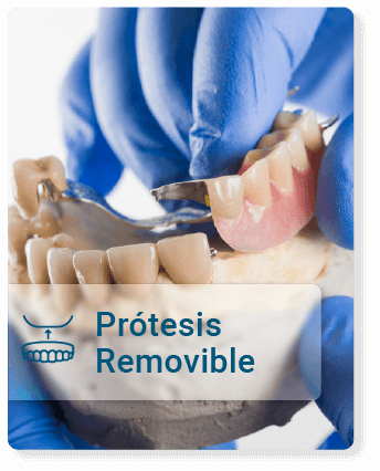 Prótesis-Removible.png