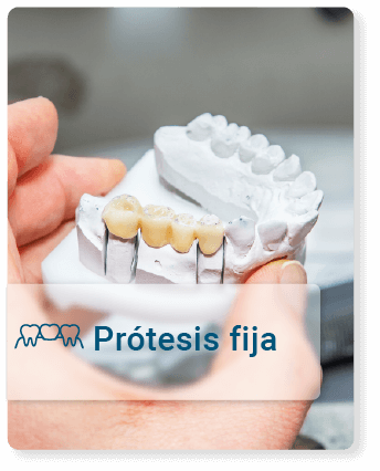 protesis-fija.png